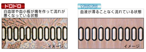 血流の様子